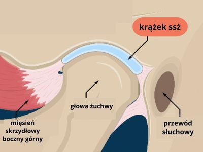 trzaski w stawie skroniowo-żuchwowym, przeskakiwanie żuchwy, kliknięcia w żuchwie, chrupanie w żuchwie, przeskakiwanie w stawie skroniowo-żuchwowym, krążek stawowy, dysk stawowy, ból stawu skroniowo-żuchwowego, ból żuchwy